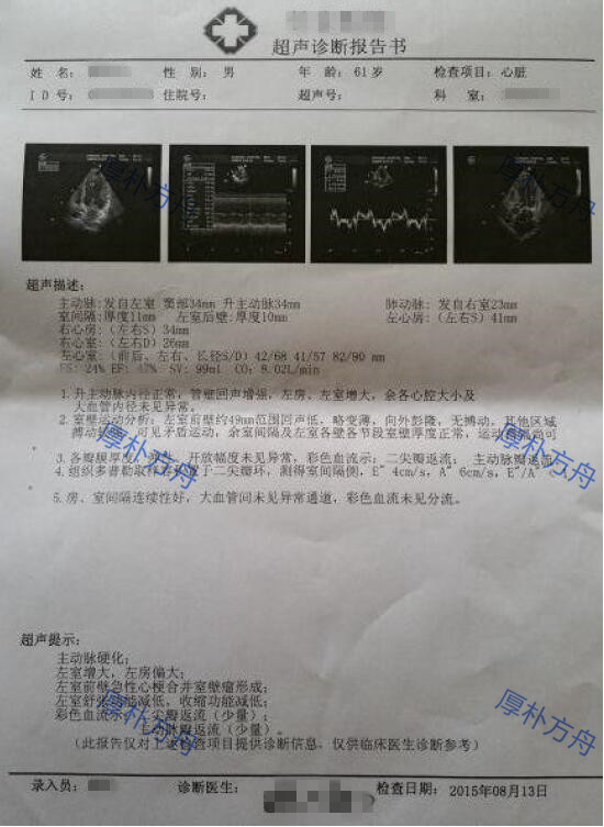 急性心肌梗塞患者榊原纪念医院搭桥手术成功案例