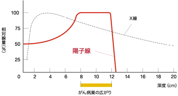 日本质子重离子放射治疗