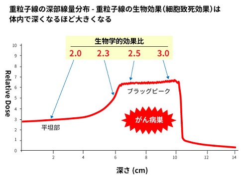 日本QST医院重离子治疗