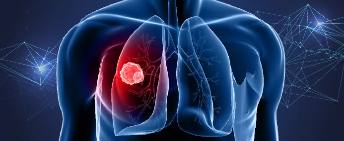 非小细胞肺癌HER2靶向药