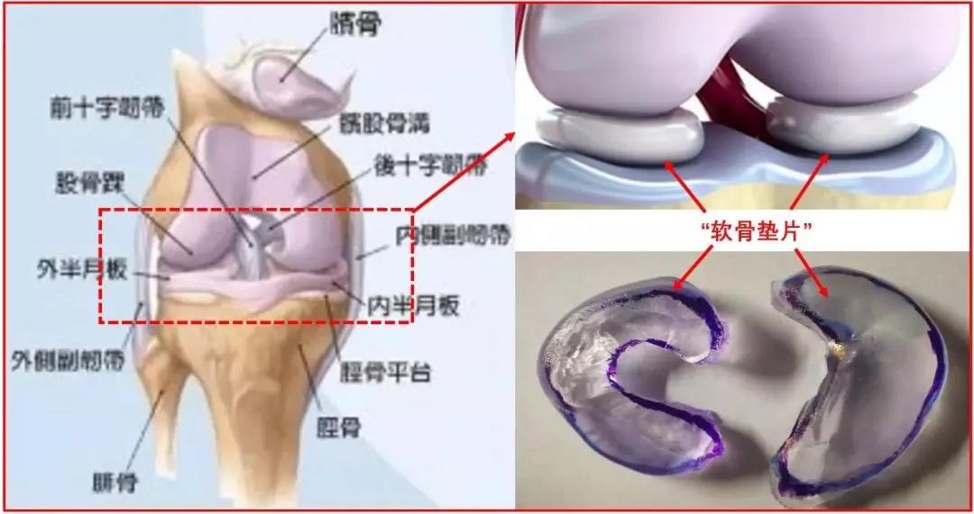 关节炎治疗