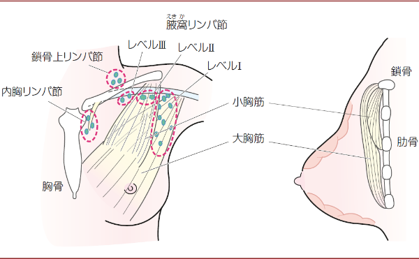 乳腺癌日本看病，乳腺癌出国看病