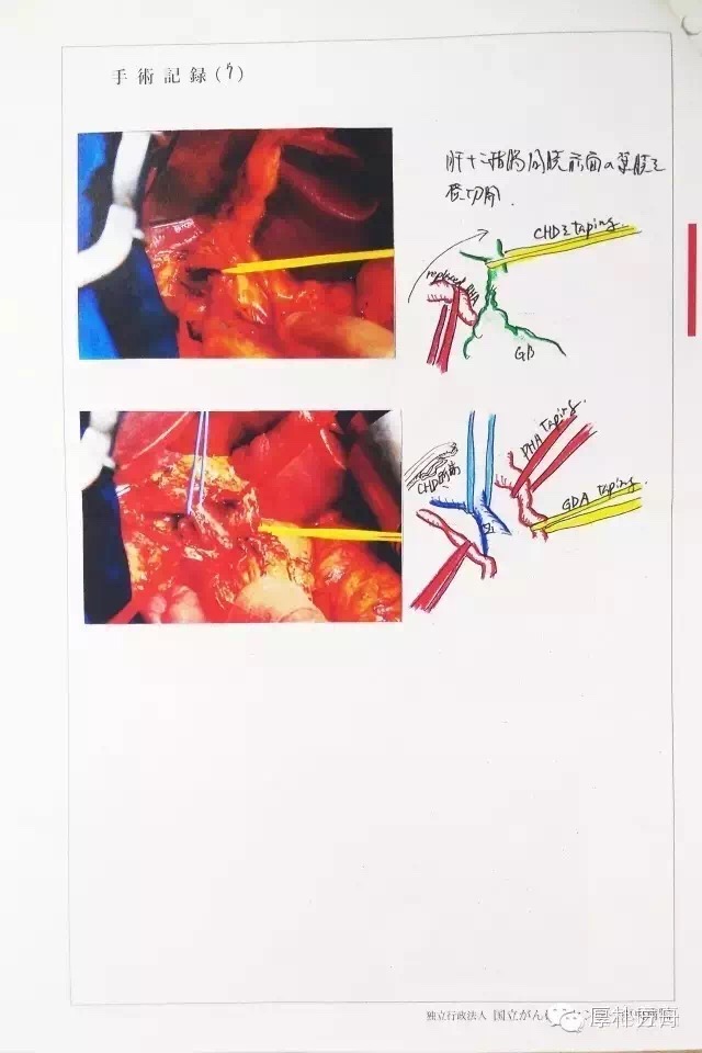 日本手术记录