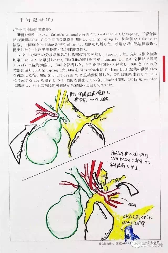 日本手术记录