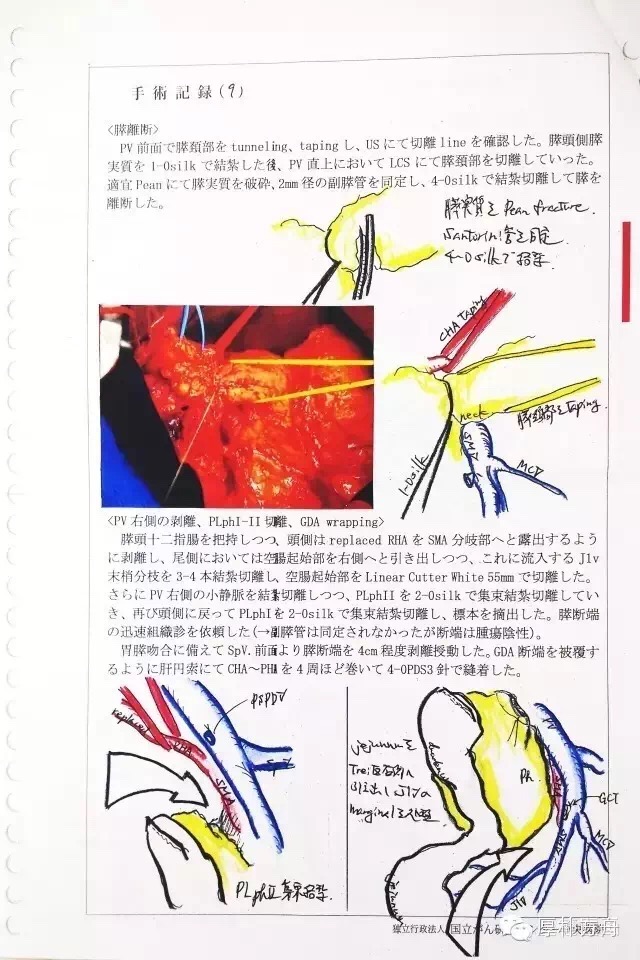 日本手术记录