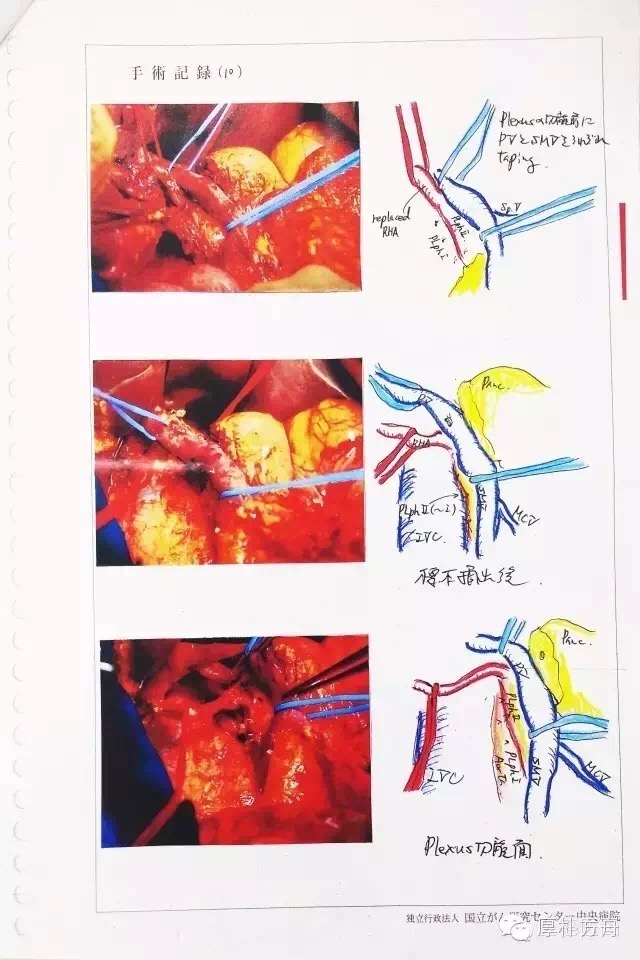 日本手术记录