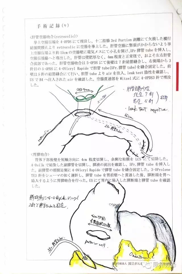 日本手术记录