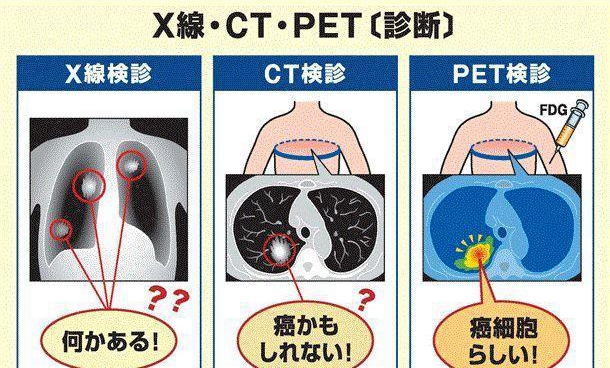 日本PET-CT