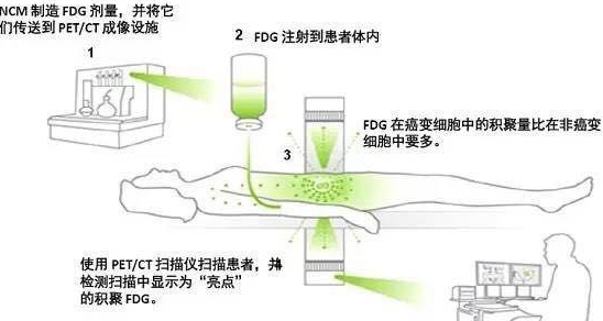 日本PET-CT