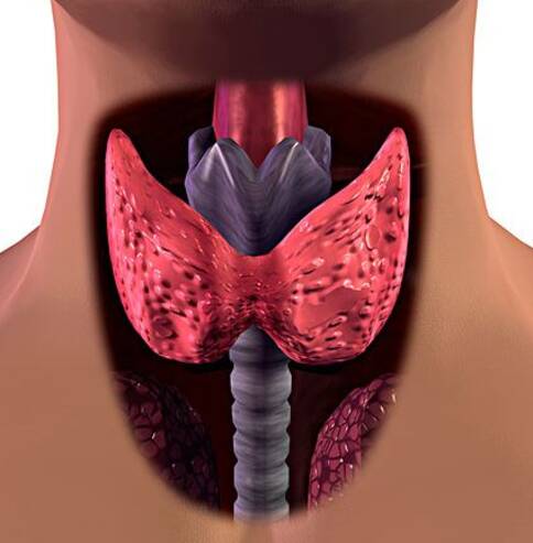 甲状腺结节,出国看病