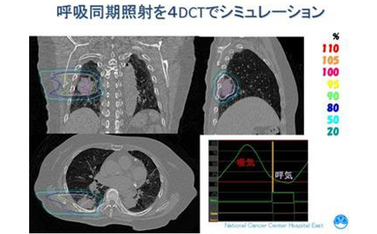 日本质子重离子治疗